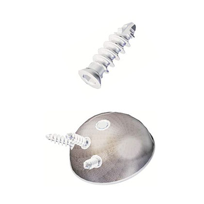 Troy & HipEx Acetabular Screw