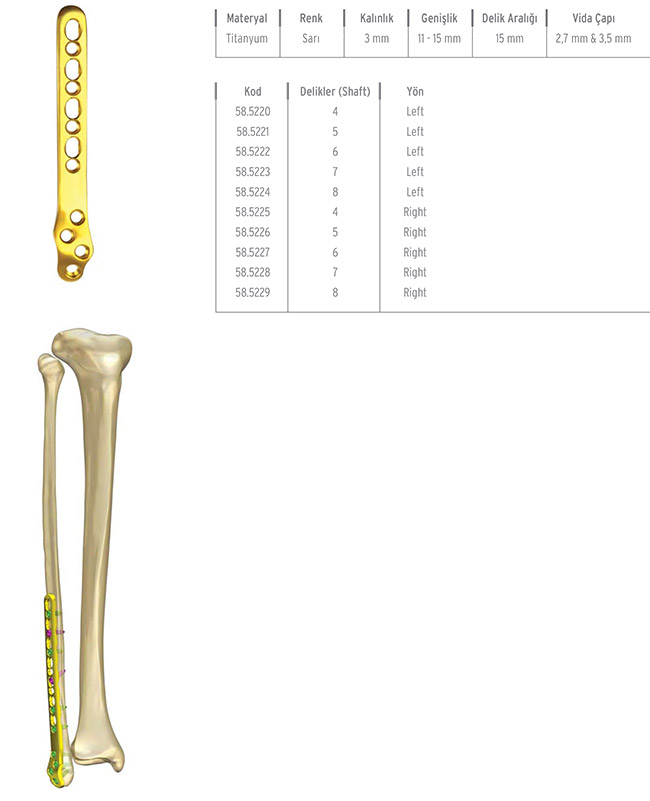 Unilock Fibula Distal Lateral Plate