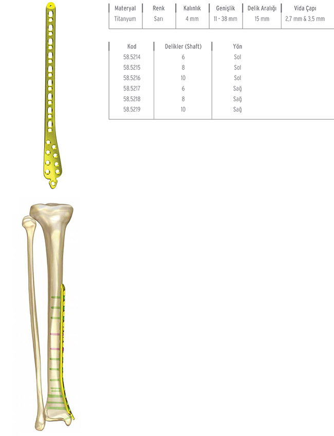 Unilock Tibia D istal Plate