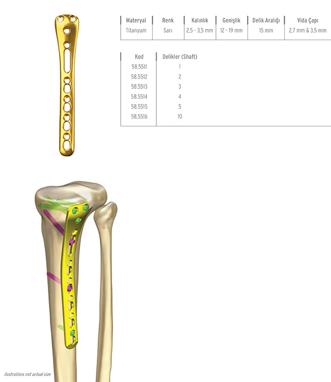 Unilock Proksimal Tibia Posterior Medial Plate