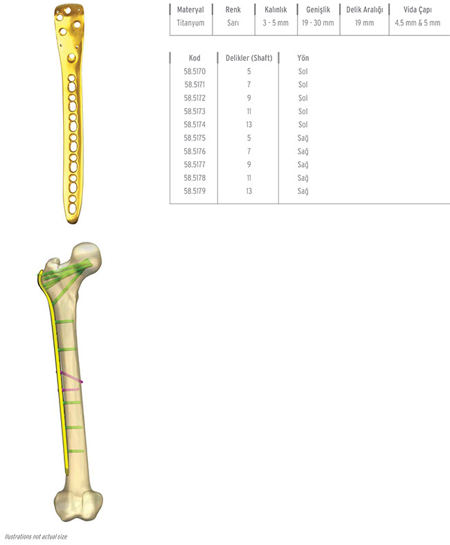 Unilock Femur Proximal Lateral Plate
