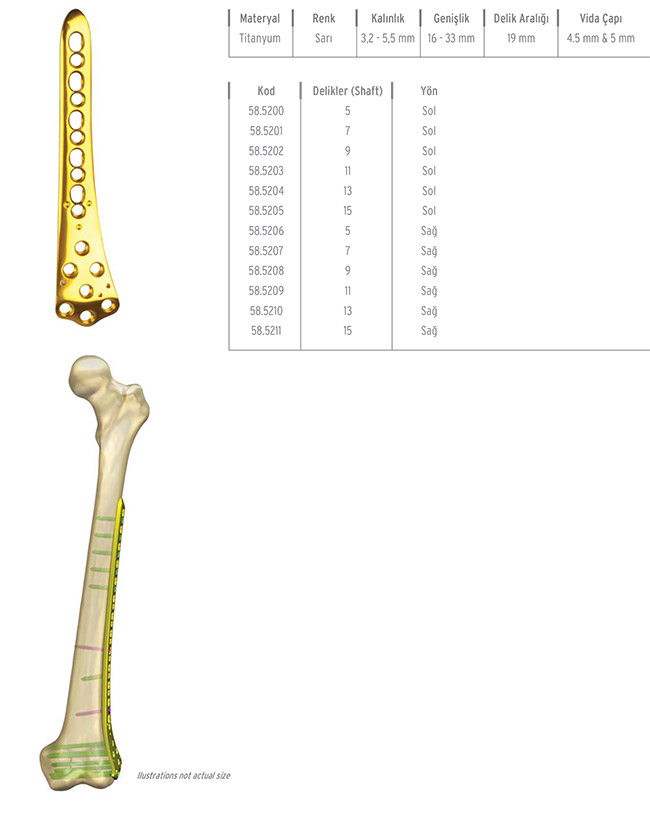 Unilock Femur Distal Plate