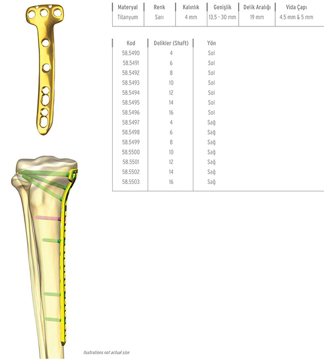 Unilock Tibia Proximal Medial Plate