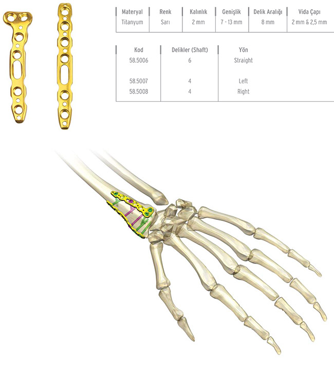 Unilock Radius Dorsal Plate