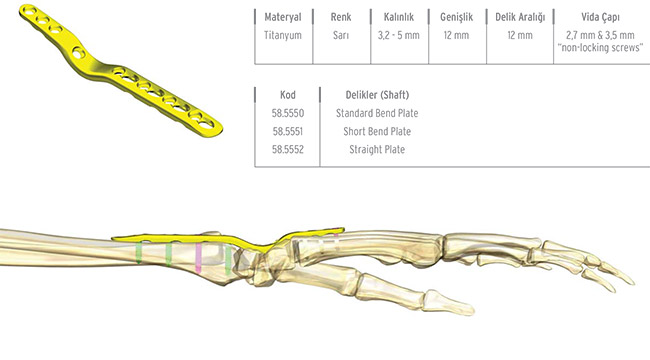 Unilock Wrist Fusion Plate 