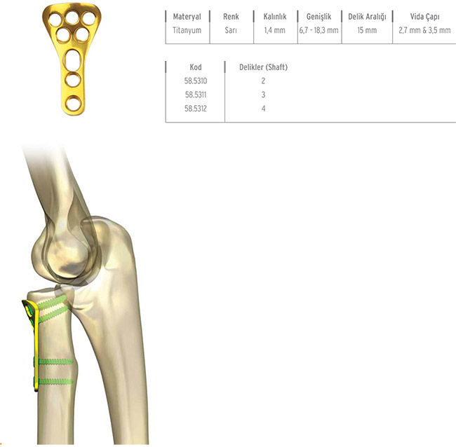 Unilock Radial Head Plade