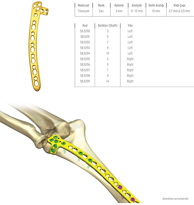 Unilock Humerus Distal Lateral Plate