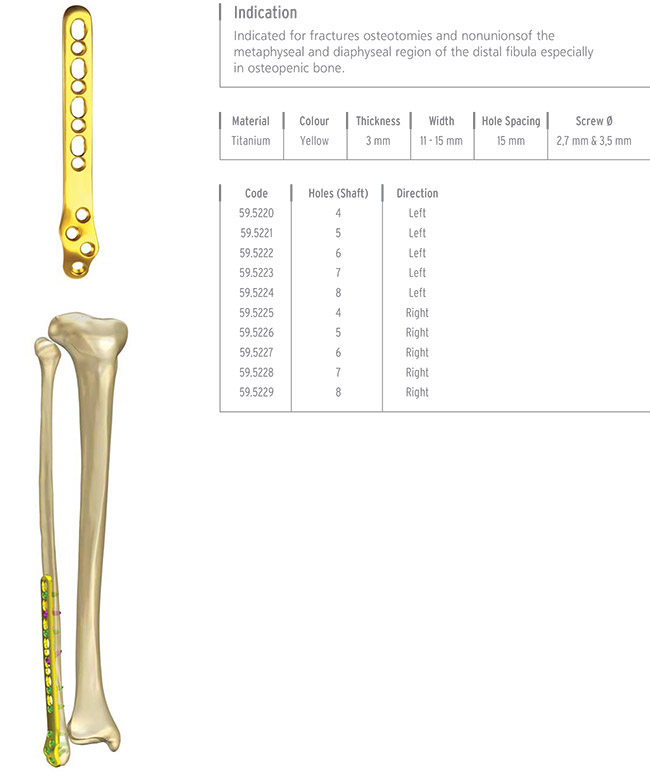 Unilock Fibula Distal Lateral Plate