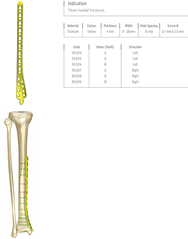 Unilock Tibia D istal Plate