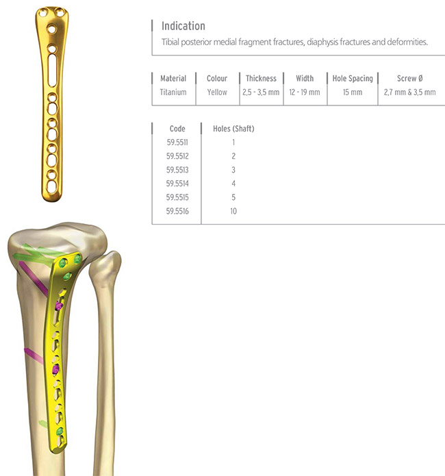 Unilock Proksimal Tibia Posterior Medial Plate