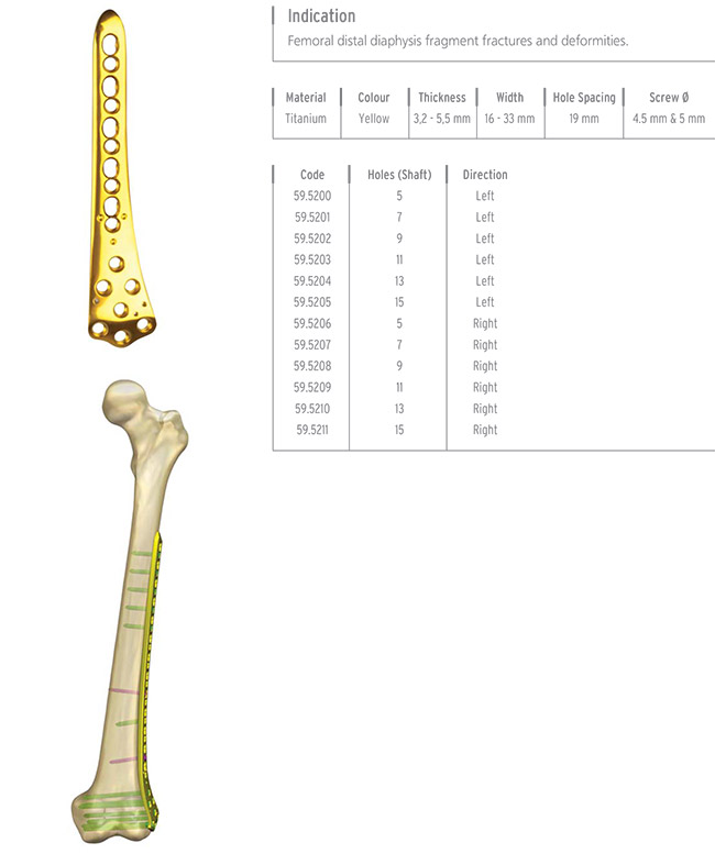 Unilock Femur Distal Plate