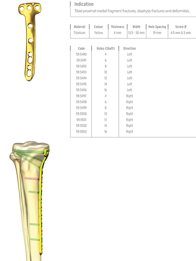 Unilock Tibia Proximal Medial Plate