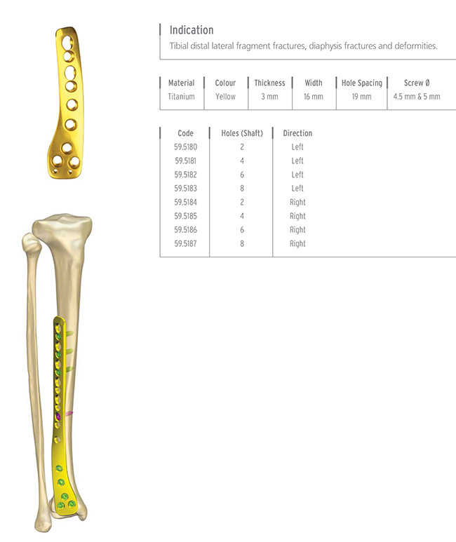Unilock Tibia Distal Lateral Plate
