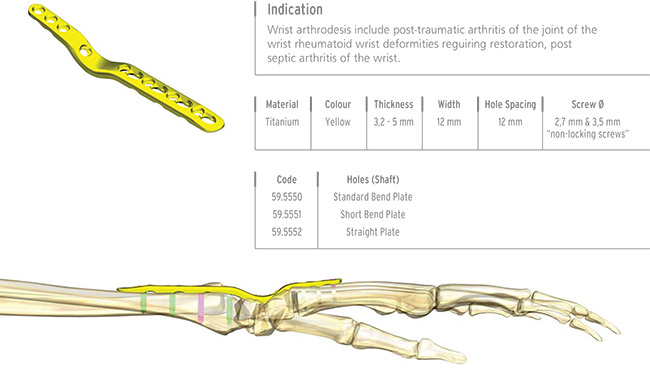 Unilock Wrist Fusion Plate 